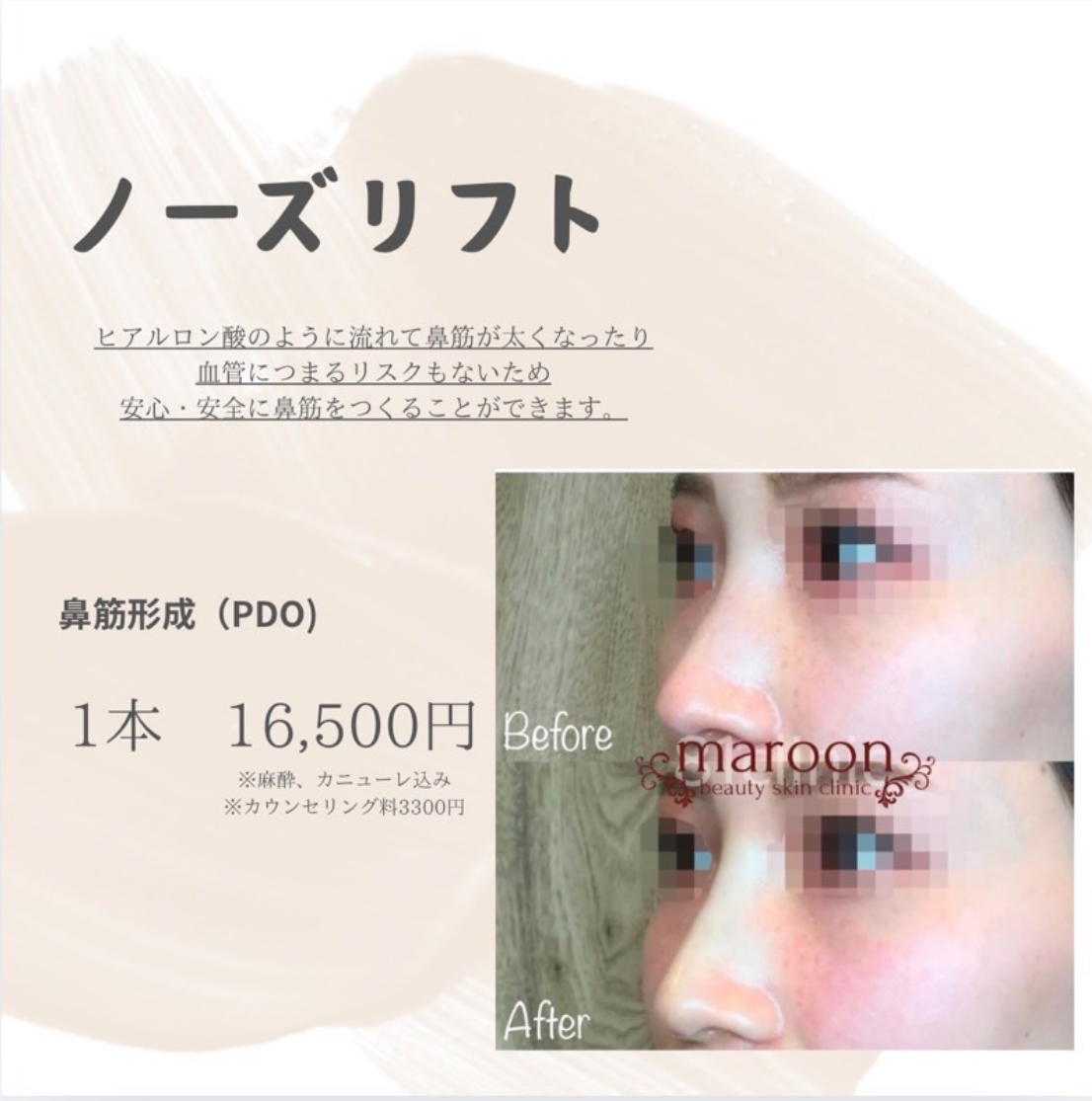 マルーンビューティスキンクリニックのモニター情報１6